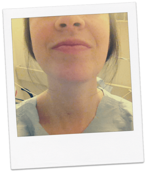 Thank You: A Thyroid Cancer Journey {Part 2} | Twin Cities Familys Blog