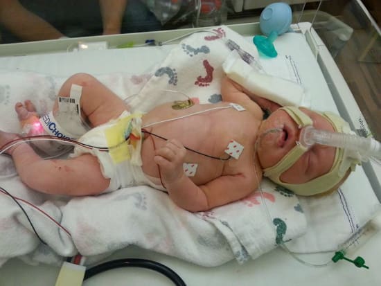 A Birth Story - Expect the Unexpected | Twin Cities Familys Blog