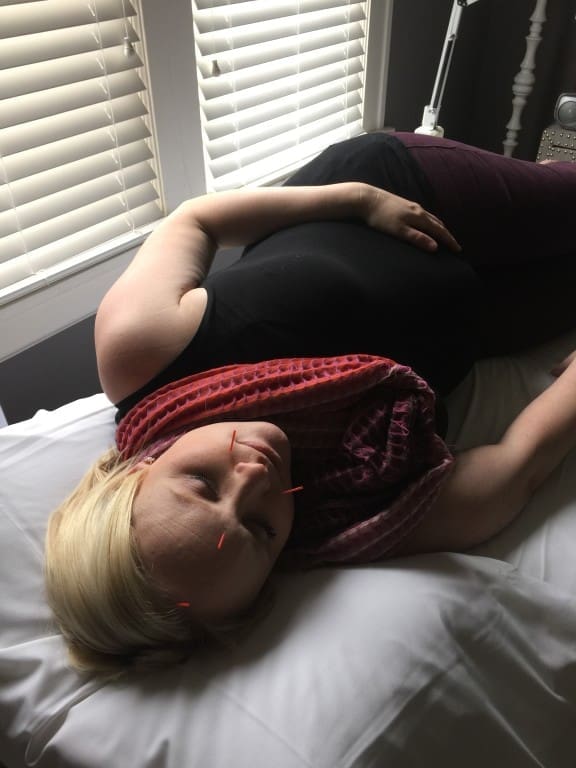 Acupuncture Helped Treat My "Mom Guilt" | Twin Cities Familys Blog