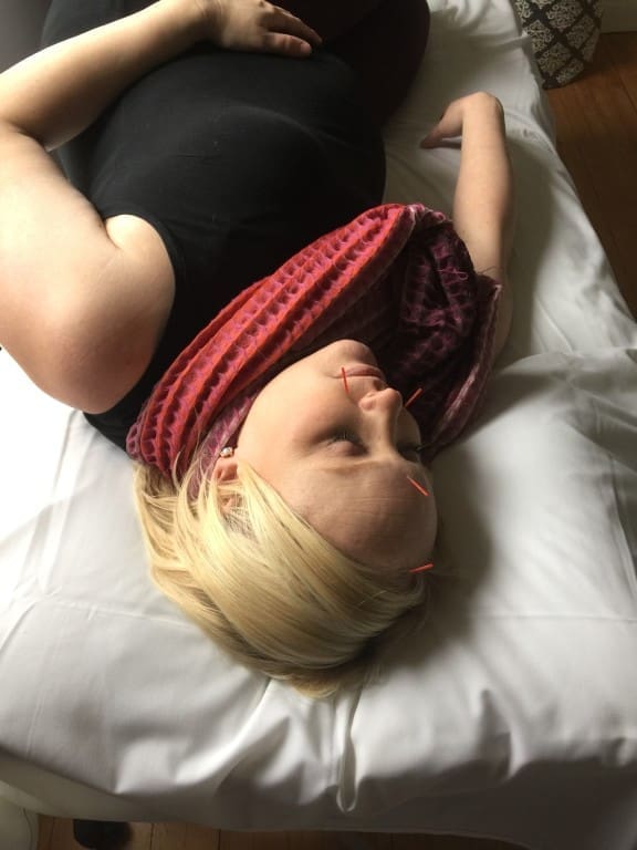 Acupuncture Helped Treat My "Mom Guilt" | Twin Cities Familys Blog