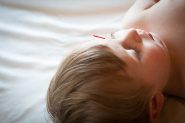 Minneapolis Family Acupuncture | Twin Cities Familys Blog