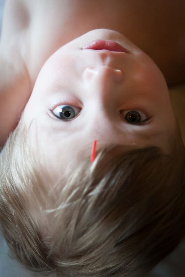 Minneapolis Family Acupuncture | Twin Cities Familys Blog