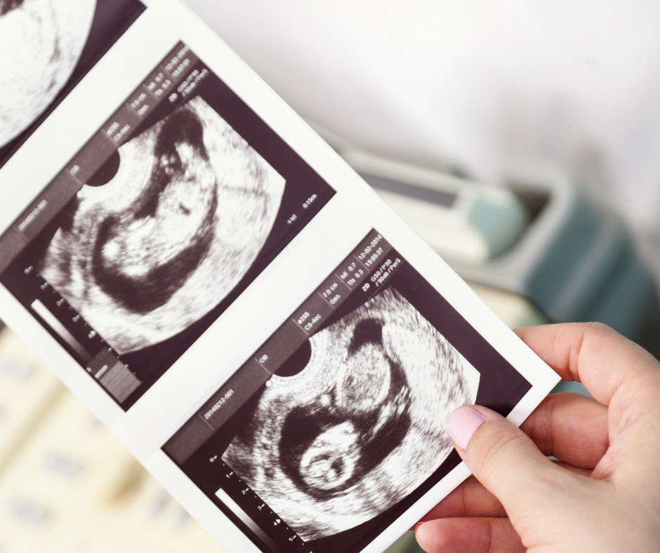 I’m Sorry: A Man’s Miscarriage Journey | Twin Cities Familys Blog