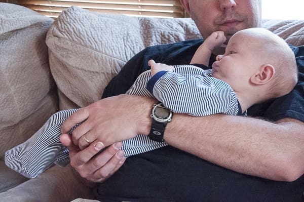 What is Craniosynostosis? | Twin Cities Familys Blog