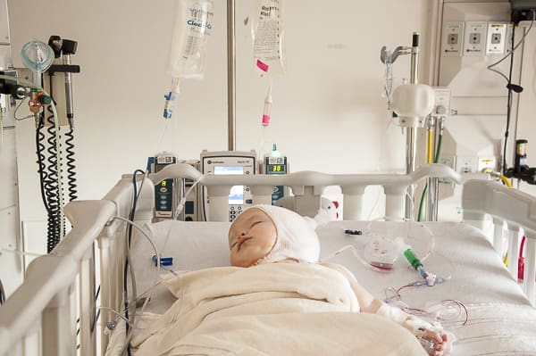 What is Craniosynostosis? | Twin Cities Familys Blog