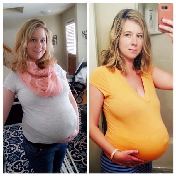 A Tale of Two Pregnancies | Twin Cities Familys Blog