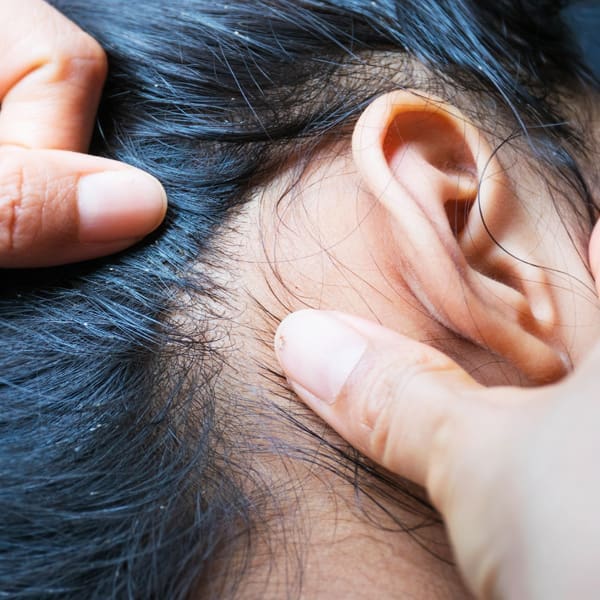 The Low-Down on Lice | Twin Cities Familys Blog